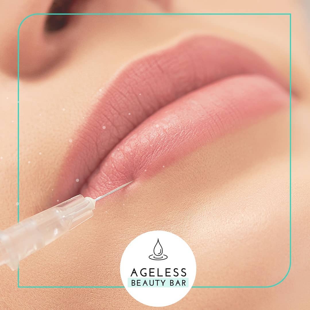 Close-up of lip filler injection